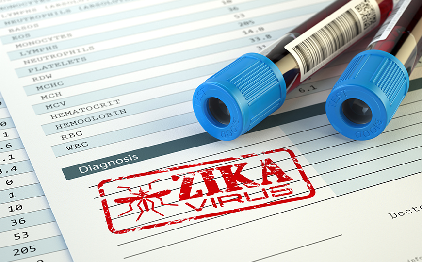 Zika virus diagnosis